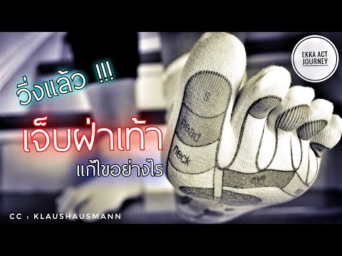 วิ่งแล้วเจ็บฝ่าเท้า (จมูกเท้า) มีวิธีแก้ไขอย่างไร