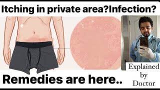 Itching over Groin area? Remedies are here | Home remedies| itching and infection in private part