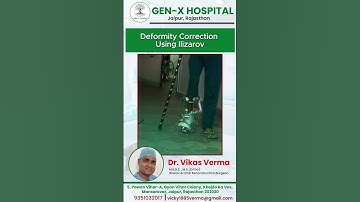 Deformity Correction Using Ilizarov
