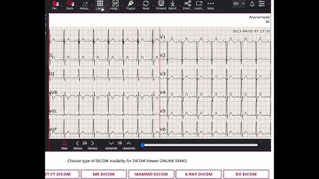 Dicom Viewer Demo with iframe integration
