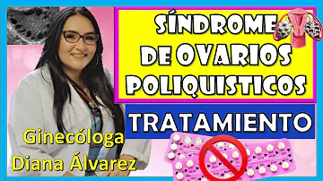 ¿Puede tratarse el SOP sin medicación?