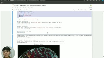Brain Tumor Detection Yolov8n Project