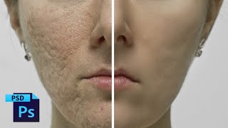 Cara Retouch Skin Photoshop Dengan Teknik Frequency Sparation