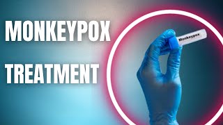 Expert Advice | Treatment Options for Monkeypox Viral Disease