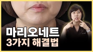 마리오네트,심술보 없애는 효과적인 방법 3가지