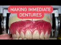 HOW TO MAKE AN IMMEDIATE DENTURES FROM A TO Z #waxbae #immediatedentures #surgicaldentures #dentures