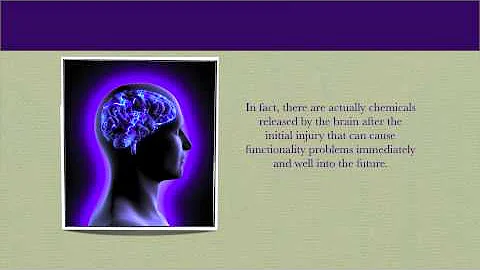 Denver Concussion Doctor: Concussion Doctor Denver: Tips for Choosing a Concussion Doctor in Denver