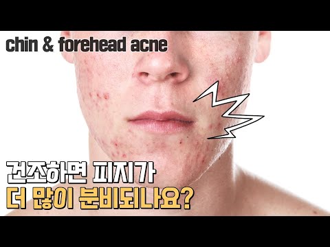 건조하면 피지가 더 많이 분비되나요?