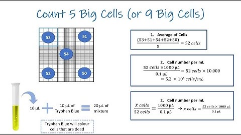 How To Count Using Haemocytometer_The Usual Method