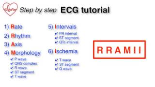 ECG Basics 1/10 - Introduction and Approach to the ECG