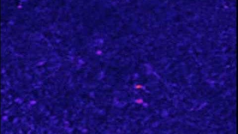 Tiny human brain made in a lab