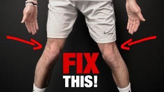 How to Fix Knee Valgus (KNEES THAT CAVE IN!)