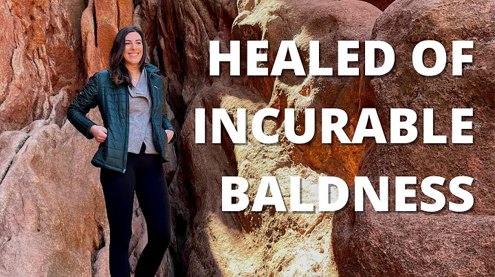 Healed of Alopecia Universalis and Baldness  Allys...