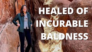 Healed of Alopecia Universalis and Baldness – Allyson Rola