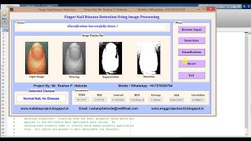 Matlab Code for FingerNail Disease Detection Using Image Processing Final Year Project