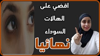 علاج الهالات السوداء/تخلصي من هالات العين واحصلي على بشرة افضل