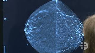 Understanding Mammograms And What To Expect When You Get One | Sanford Health News