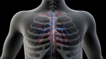 Heart Bypass Surgery - Successfully Operate of a Heart | Heart Bypass Animation|