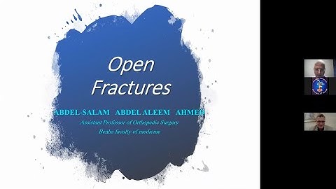 Open Fractures ( Prof. Abdel- Salam  Abdel-Aleem )