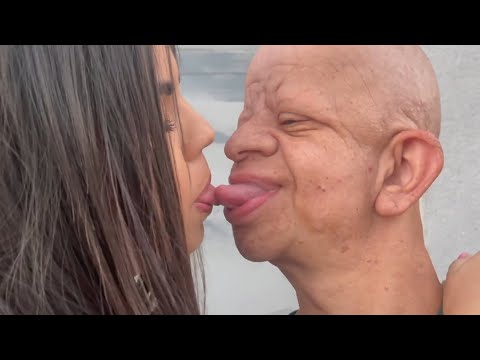 Bruno Diferente causa polêmica por video beijando menor