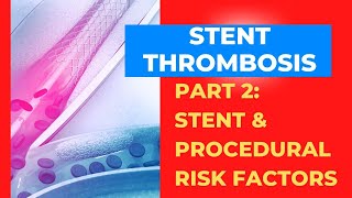 Stent Thrombosis Part 2: A focus on the stent and procedural risks