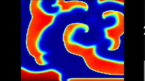 Spatiotemporal Chaos in the Fenton Karma model caused by Ectopic Stimulation