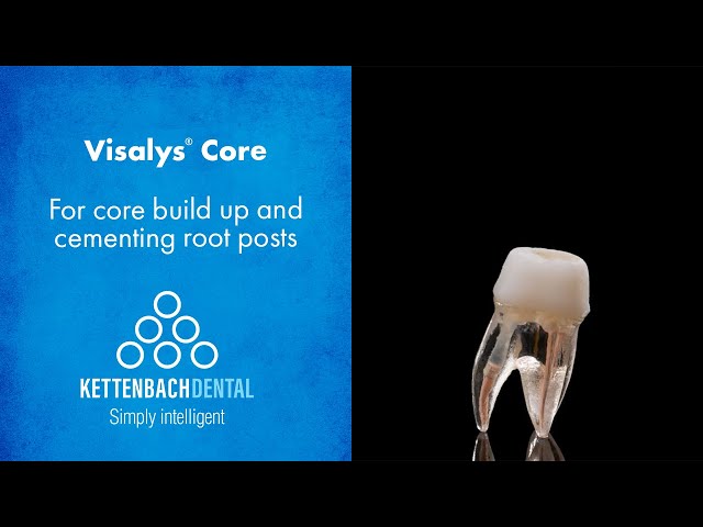 So stable is Visalys® Core  - for core build up and cementing root posts.