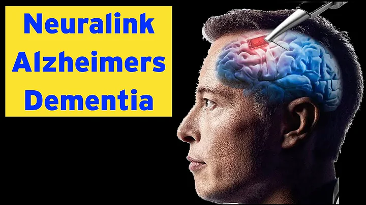 Live: Neuralink - Alzheimer's - Dementia