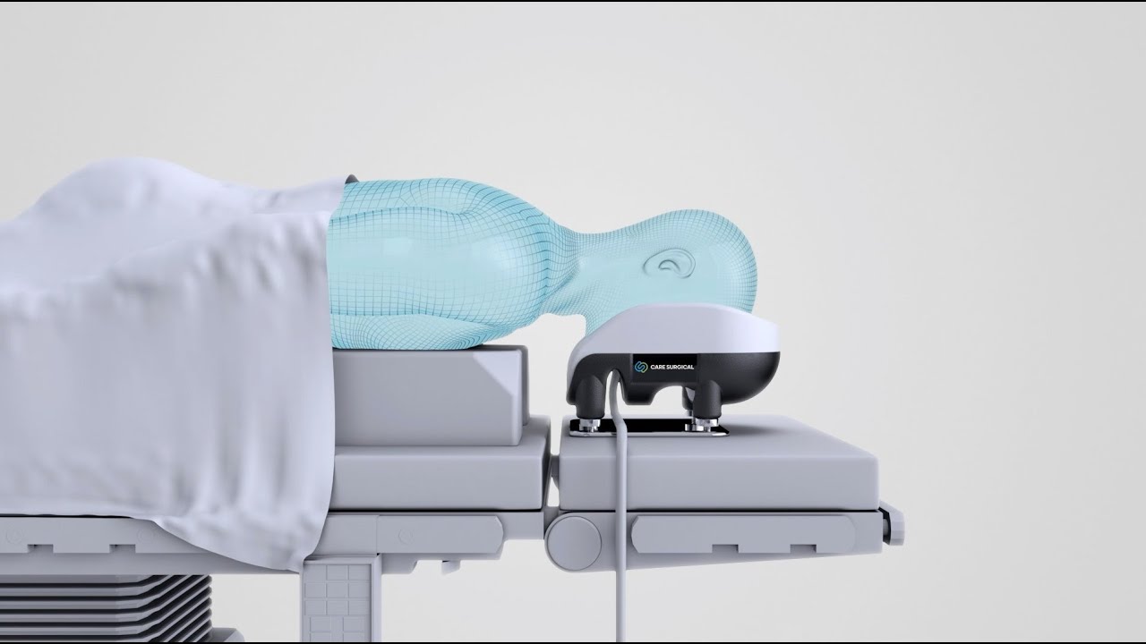 Care Surgical Prone Plus Head Support System YouTube