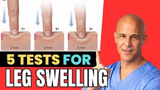 After 60: 5 Simple Tests to See If Your Medication Is Causing Swollen Legs | Dr. Mandell