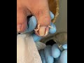 Satisfying Toenail Trim for Clean Foot Care #ToeCare #ToenailTrim #GroomingRoutine #CleanNails