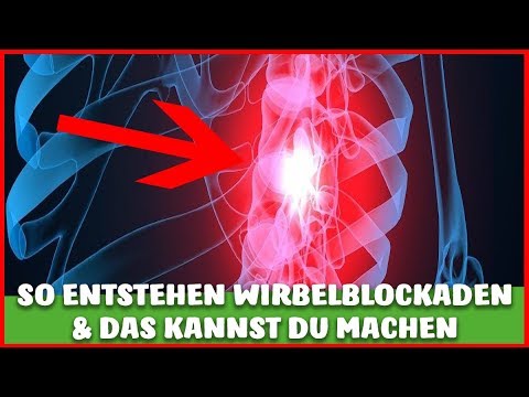 Video: Was Ist Das Kunststück Der Blockade?