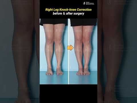 [before ＆ after]