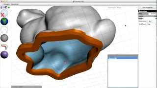 Famous mm08 thicken/shell tutorial Net Worth