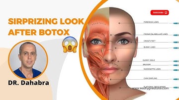 How to fix Spock Eyebrows After Botox | Surprising Look After Botox Eyebrow Lift | Dr. Dahabra
