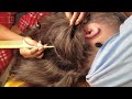 Scalp Scratching And Nitpicking | ASMR | Not Talking