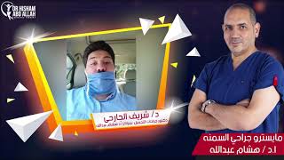 #معلومة_ع_الماشي |  شكل الجسم بعد جراحات السمنة مع د شريف الجارحي