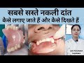 सबसे सस्ते नकली दांत कैसे लगाते हैं और वह कैसे दिखते हैं||How To Fix Removable Partial Denture(RPD)