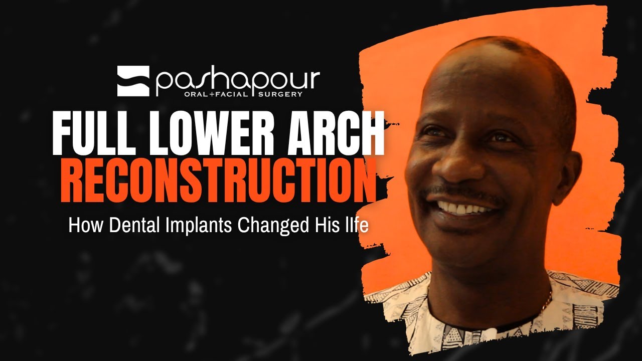 A New Smile, A New Journey: Our Patient’s Full Lower Arch Reconstruction