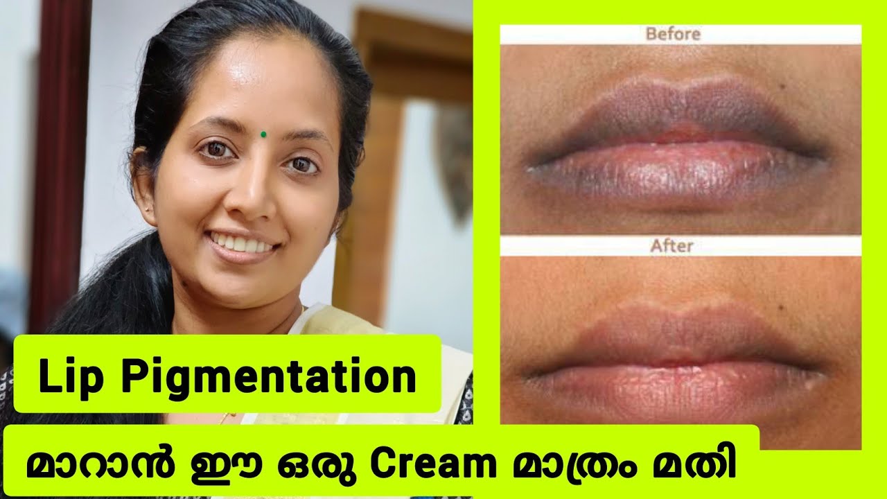 Best Lip Lightening Cream Malayalam Lip Pigmentation മാറാൻ YouTube