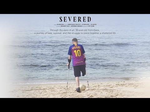 Severed: The Story of a Boy From Gaza