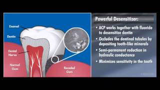 Enamel Pro Varnish Dentrek Module