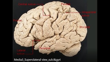 Sensory (parietal) cortex