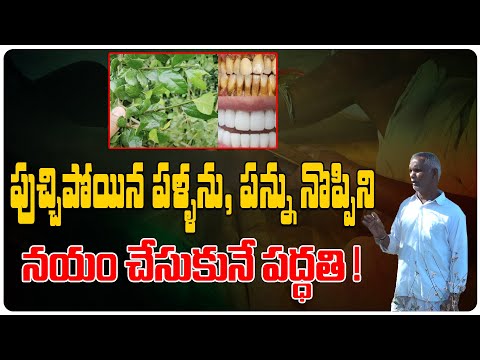 Remedies for Toothache| Panti Noppi | Tooth Pain Relief | Pippi Pannu Remedy | Tree Media