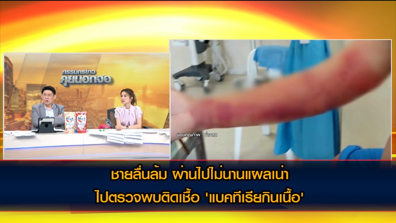 มุกดาหาร  ชายลื่นล้ม ผ่านไปไม่นานแผลเน่า ไปตรวจพบติดเชื้อ 'แบคทีเรียกินเนื้อ'
