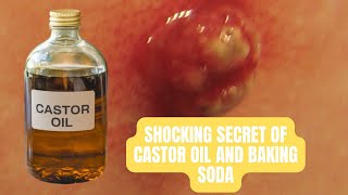 The Secret Power of Castor Oil and Baking Soda | Natural Remedies You Need to Try