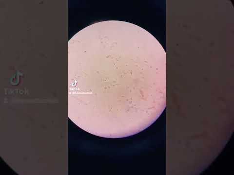 vaginal swab under the microscope #microscope #sperm #vaginalswab #wetmount