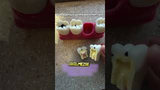 Son Aşamaya Gelmesin 🦷🪥