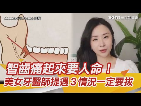 智齒要拔嗎？拔智齒會痛嗎？有3種情況一定要拔！牙醫教你3招減輕疼痛！不拔智齒會怎樣？智齒一定要拔嗎？智齒怎麼拔？拔智齒注意事項有哪些？｜健康資訊、健康知識 都在 祝你健康｜@DrTeresa