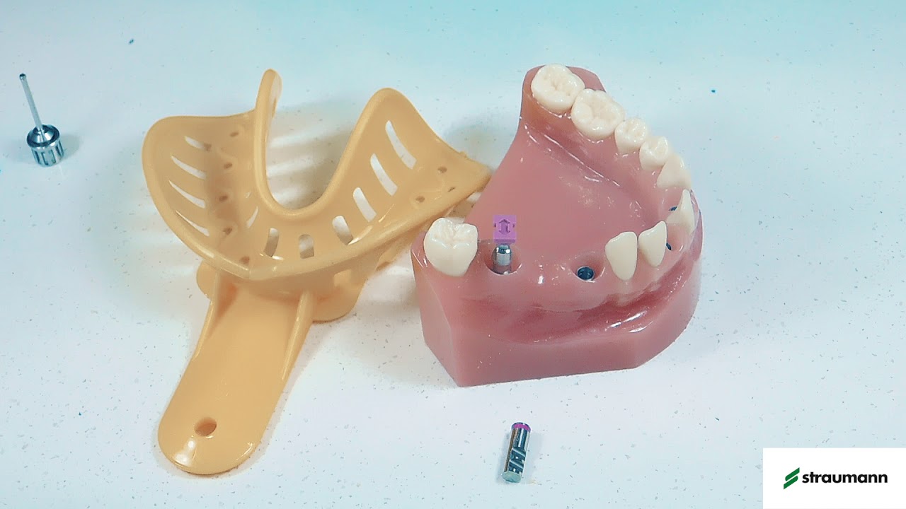 Toma de impresión Cubeta Cerrada implante Bone Level